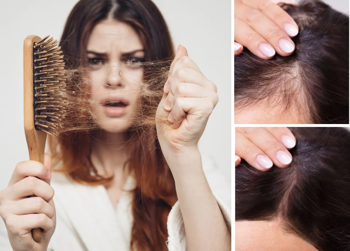 Chia sẻ cách trị rụng tóc đơn giản nhưng cực hiệu quả